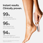 Esenyx Pro Callus Remover